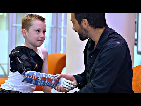 An Affordable 3D-Printed Arm