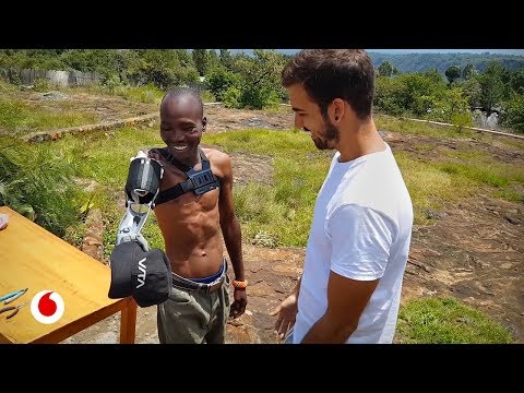 Prótesis impresas en 3D para personas de países sin recursos