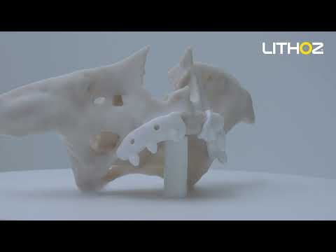 Erstmals in der Geschichte der Chirurgie | 3D-gedrucktes keramisches subperiostales Kieferimplantat