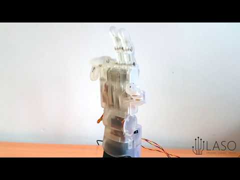 Student built 3D-printed bionic hand