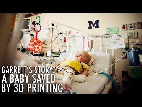 3D printed devices save baby&#039;s life at University of Michigan&#039;s C.S. Mott Children&#039;s Hospital