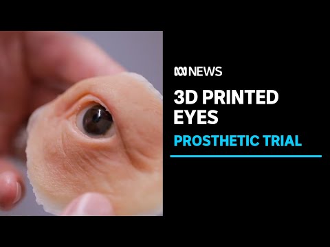 The new 3D printing technology revolutionising artificial eyes for patients | ABC News