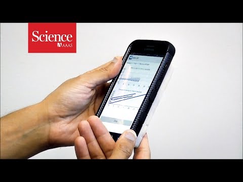 This modified smartphone measures blood pressure directly from your finger