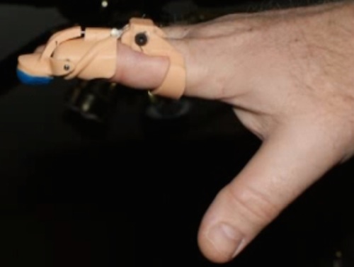 3d-printed-finger-prosthetic