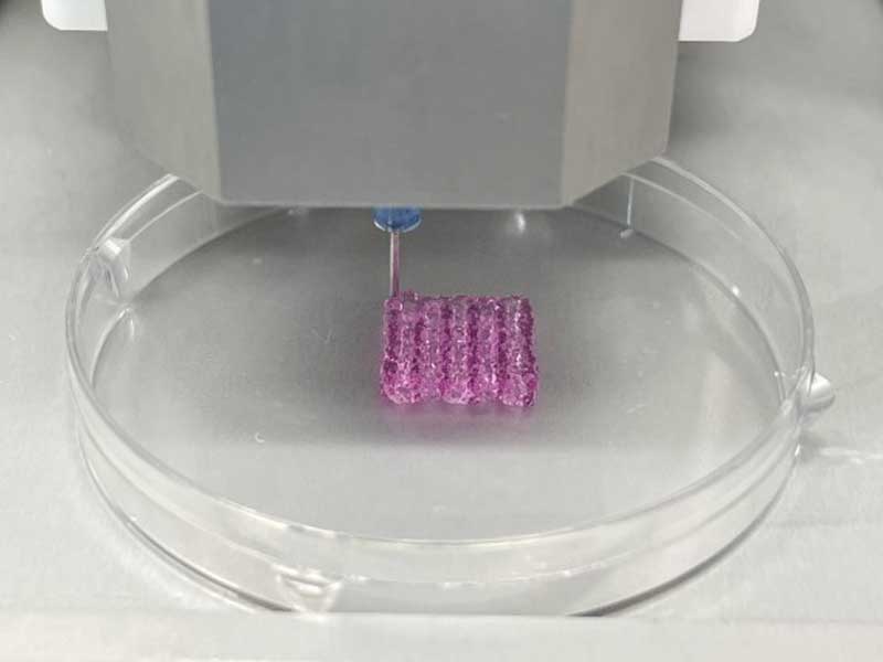3D bioprinting technology is said to be used to remove cancer cells