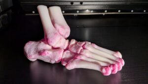 Sheffield eröffnet 3D-Drucklabor für patientenspezifische Operationsmodelle